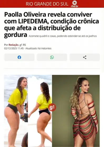 Paolla Oliveira revela conviver com lipedema